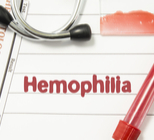 הפרעות בקרישת הדם - תמונת המחשה